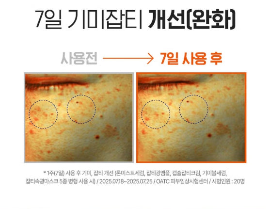 Liposome Vitamin C Capsule Blemish Cream 55ml