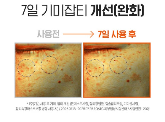 Liposome Vitamin C Blemish Light Mask 31g (1 sheet)